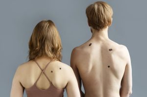 מיפוי שומות