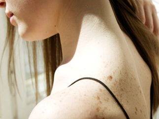 ביופסית עור - מתי עושים ולמה זה חשוב